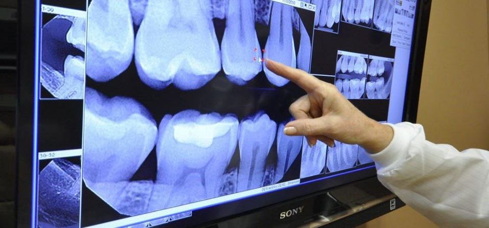 Radiografia Digital