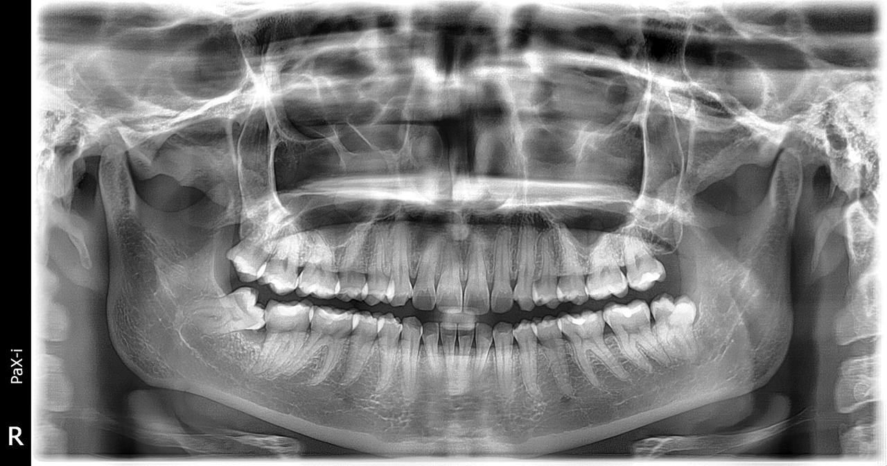 Radiografia Panorâmica